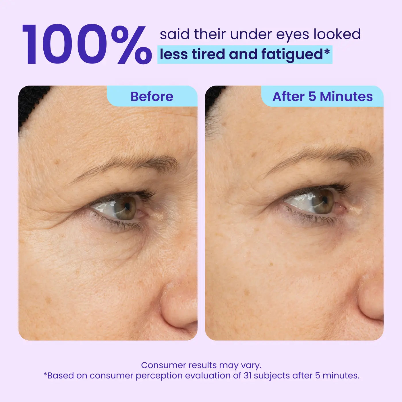 Instant Lift Eye Gel for Puffiness, Bags & Dark Circles