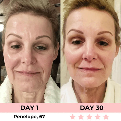 Aurora® 7-in-1 EMS + Red Light Therapy To Lift & Sculpt Your Face