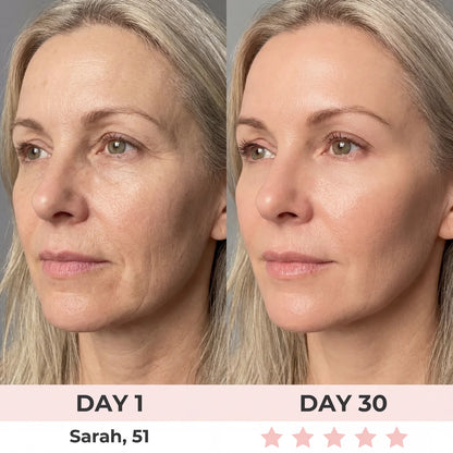 Aurora® 7-in-1 EMS + Red Light Therapy To Lift & Sculpt Your Face