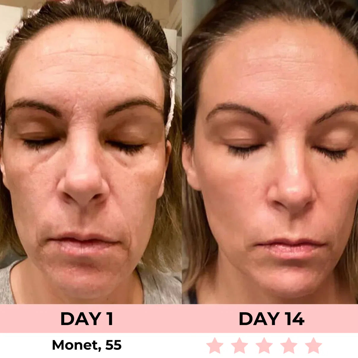 Aurora® 7-in-1 EMS + Red Light Therapy To Lift & Sculpt Your Face