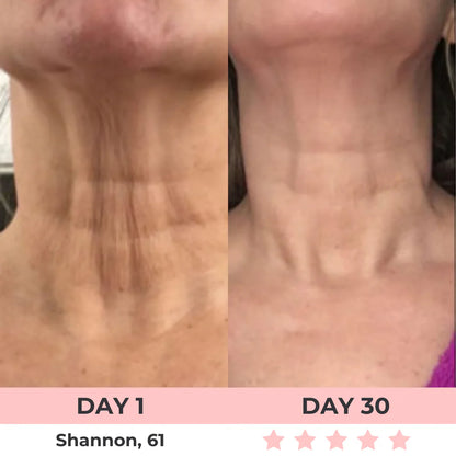Aurora® 7-in-1 EMS + Red Light Therapy To Lift & Sculpt Your Face