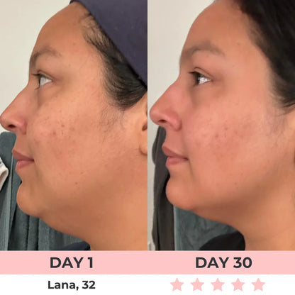 Aurora® 7-in-1 EMS + Red Light Therapy To Lift & Sculpt Your Face