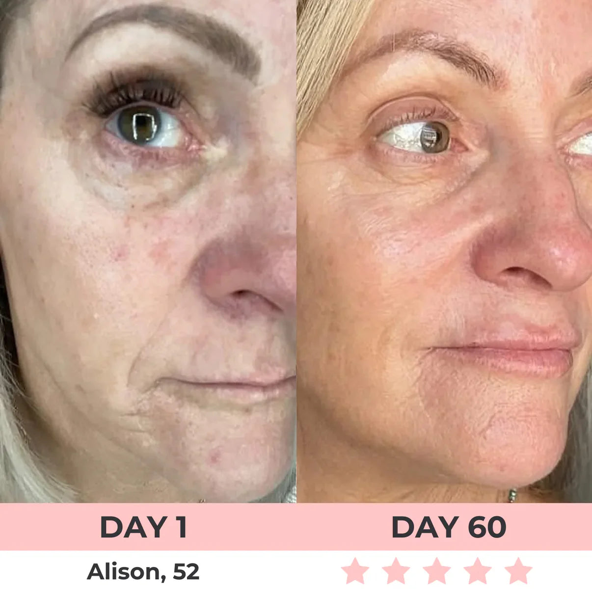 Aurora® 7-in-1 EMS + Red Light Therapy To Lift & Sculpt Your Face