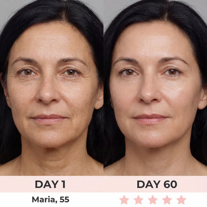 Aurora® 7-in-1 EMS + Red Light Therapy To Lift & Sculpt Your Face
