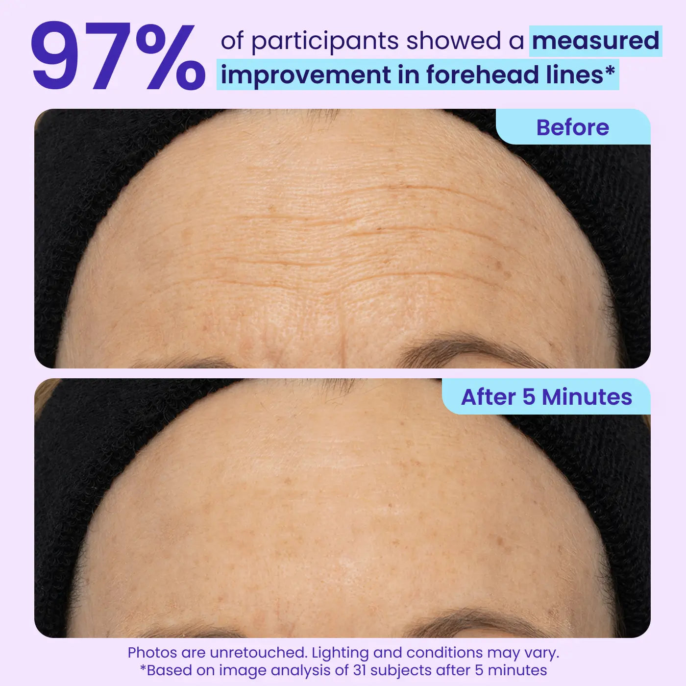 Instant Lift Eye Gel for Puffiness, Bags & Dark Circles