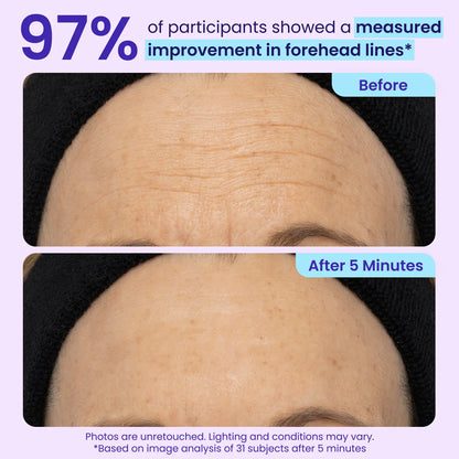 Instant Lift Eye Gel for Puffiness, Bags & Dark Circles
